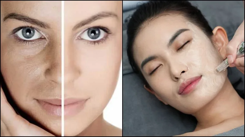 BB Glow – Tratamento facial Coreano