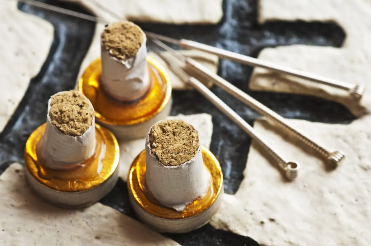 Moxibustion und Akupunkturnadeln