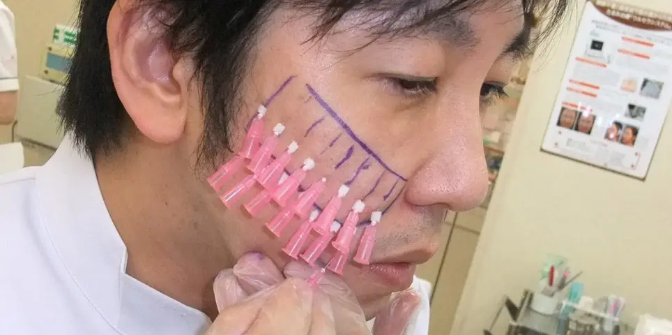 12 Procedimentos estéticos que só existem no Japão